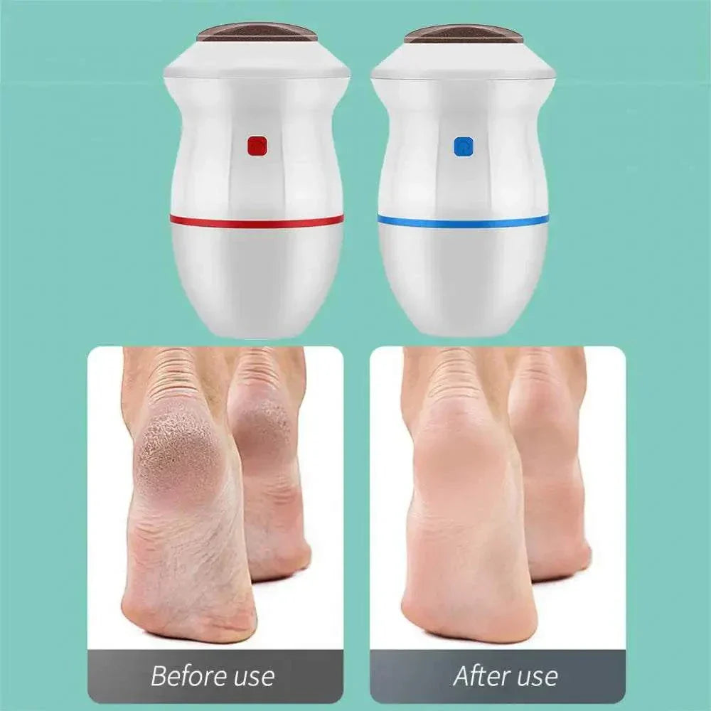 Electric foot grinder with built-in vacuum for effortless heel care, before and after use comparison.